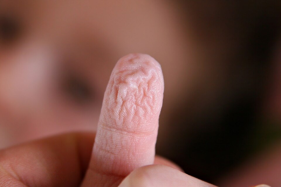 Why do fingers go wrinkly in the bath?